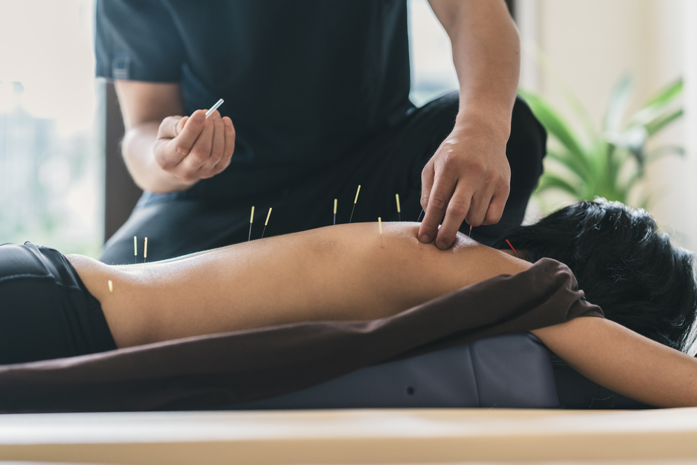 Dry Needling in Overland Park